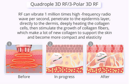 Shape Tactics 9-in-1 Lipo Microcurrent Photon Ultrasonic Cavitation System