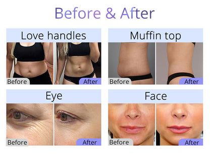 Shape Tactics 9-in-1 Smart RF 3D Cavitation System