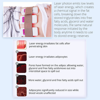 Shape Tactics Advanced 5-in-1 Cryolipolysis 40K Cavitation RF Lipo Laser System