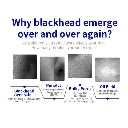 Shape Tactics Microdermabrasion Vacuum Spray for Deep Facial Exfoliation