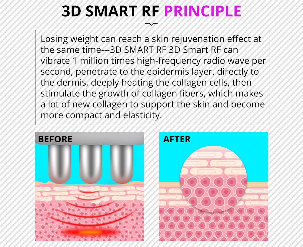 Shape Tactics 5-in-1 Ultrasonic Cavitation Vacuum RF Beauty System
