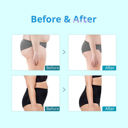 Shape Tactics Portable Double-Handle Cryolipolysis Contouring System