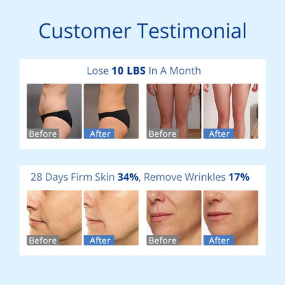 Shape Tactics S-Shape 30K Cavitation RF & 160mW Lipo Laser System