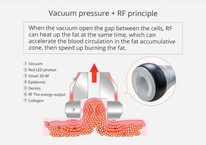 Shape Tactics Unoisetion 40K Cavitation Ultrasound RF Vacuum Photon System