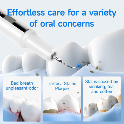 T7 Ultrasonic Tooth Cleaner | Advanced Plaque & Tartar Removal