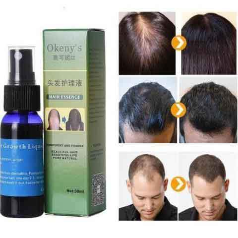 Hair growth essence bottle and green box with scalp comparison thumbnails